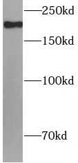 anti- CD280 antibody