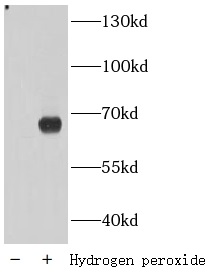  anti- Phospho-AMPKA1(T183)/AMPKA2(T172) antibody