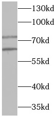  anti- YY1 antibody