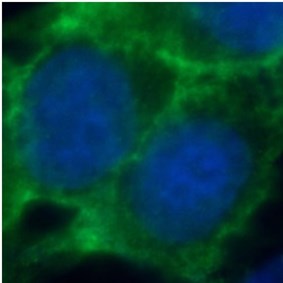 anti- E-cadherin antibody