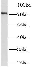 <strong><strong><strong><strong><strong><strong><strong><strong><strong>GHR抗體</strong></strong></strong></strong></strong></strong></strong></strong></strong>