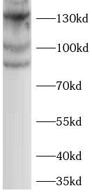  <strong><strong><strong>ELKS抗體</strong></strong></strong>