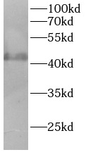      anti-AURKA antibody