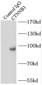 anti- beta-Catenin antibody