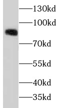 anti-beta-Catenin antibody