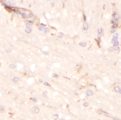 CD81抗体