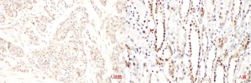 Immunohistochemistry-FNab07877 anti- SIRT1 antibody (200倍放大)