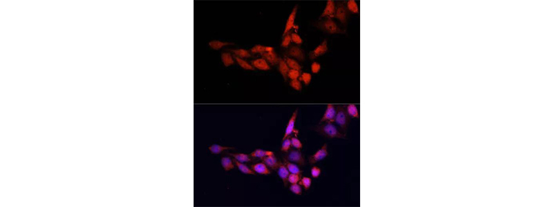 Immunofluorescence-FNab07877 anti- SIRT1 antibody (200倍放大)