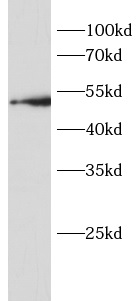      anti- BACE1 antibody
