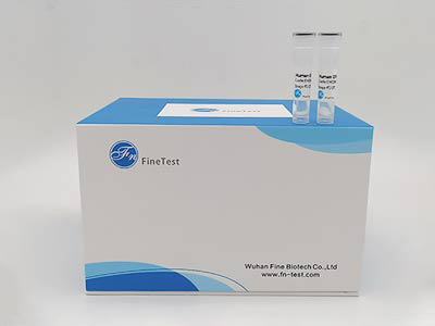 人前列腺素F2α(PGF2α)elisa试剂盒