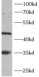 anti-SCF antibody