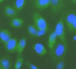      anti-sumo antibody