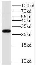      anti-TOLLIP antibody