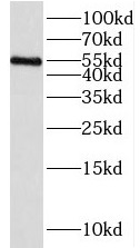      anti-IRAK4 antibody