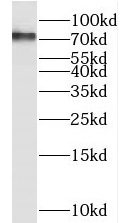      anti-RIP1 antibody