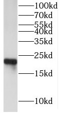 anti-cygb antibody