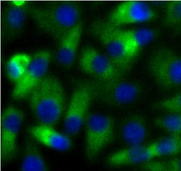 anti-ubc13 antibody