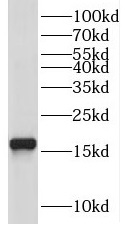 anti-ubc13 antibody