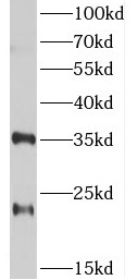 anti-TSN12 antibody