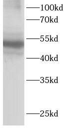      anti-MATK antibody