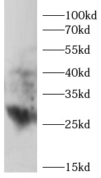      anti-SFRP2 antibody