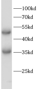      anti-EGLN1 antibody