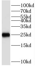 HMGB1抗体