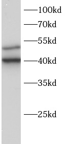 anti-SLAP1 antibody