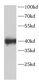      anti-SIR6 antibody