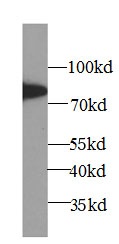 5 Lipoxygenase抗体