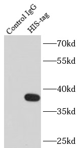      anti- 6*His, His-Tag antibody