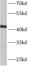      anti-ACTR1B antibody