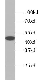      anti-ACADM antibody