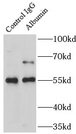 anti- Albumin antibody