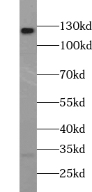      anti-ABL2 antibody