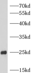      anti- ARHGDIG antibody