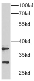 anti- ARMC10 antibody