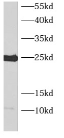 anti- ARL4C antibody