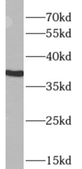      anti- APOL2 antibody