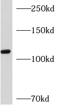      anti- AP3D1 antibody