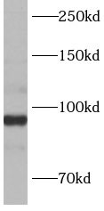      anti- APC4 antibody