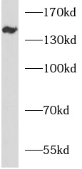 anti- ANKRD50 antibody