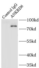      anti- ANKRD6 antibody