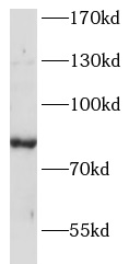      anti- ANKRD6 antibody