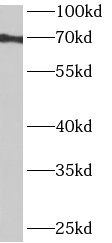 anti- ANKRD55 antibody