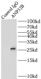      anti- ANP32B antibody