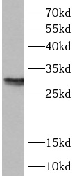      anti- ANP32B antibody