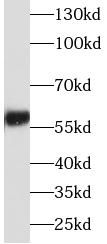      anti- ALDH6A1 antibody