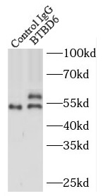 BTBD6抗体