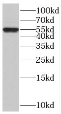      anti- BTBD6 antibody